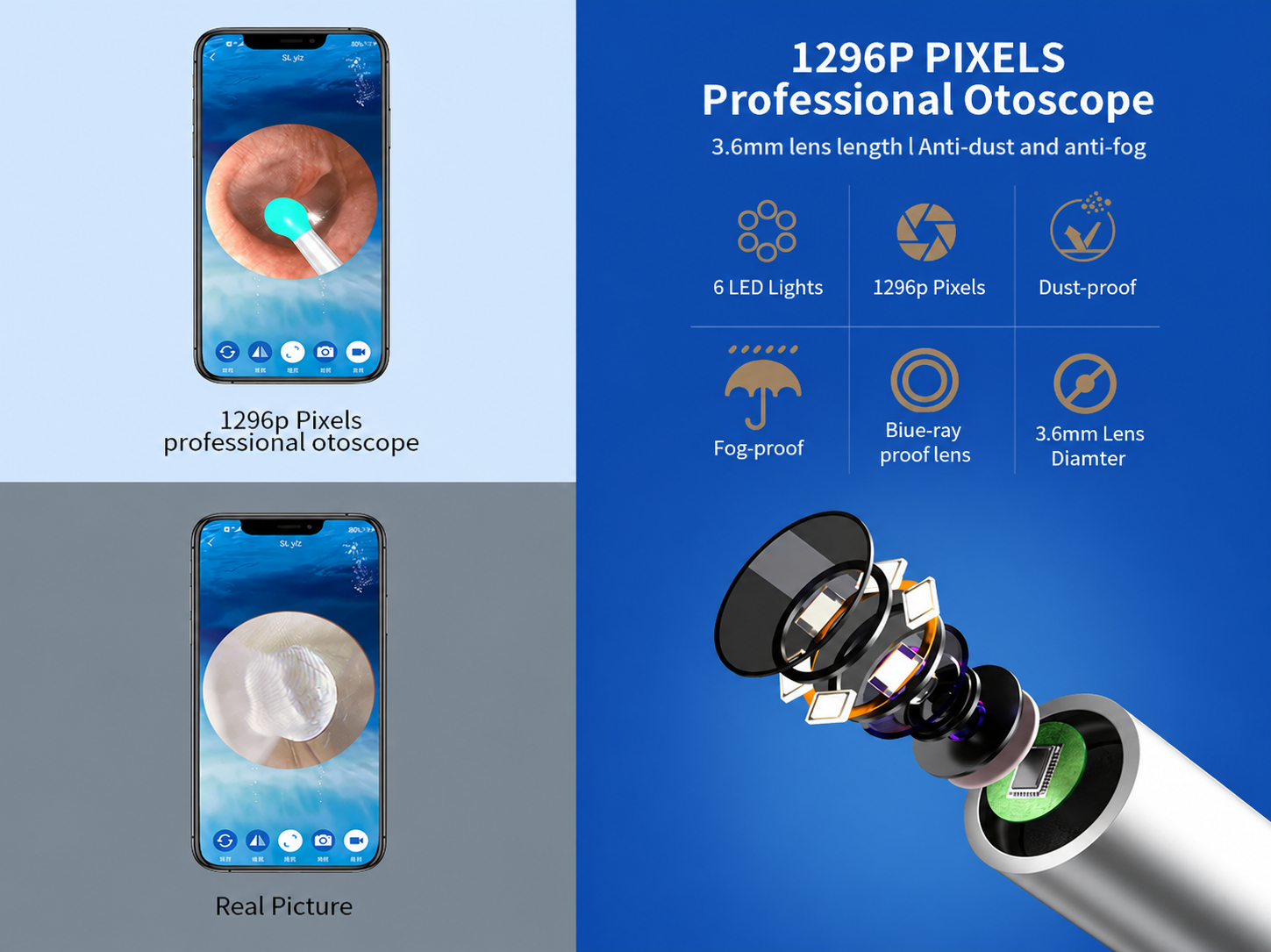 Detailed diagram of the 1296P otoscope camera and its six-LED ring on the wand tip.