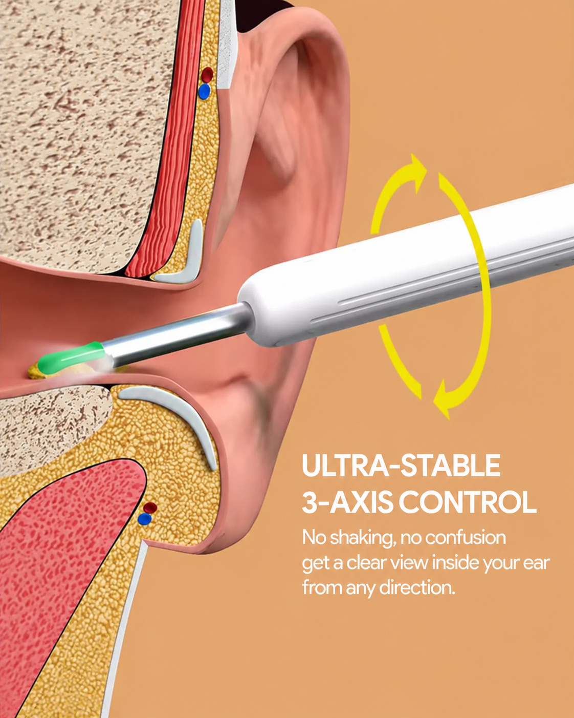 Illustration showing wax naturally moving outward in the ear canal